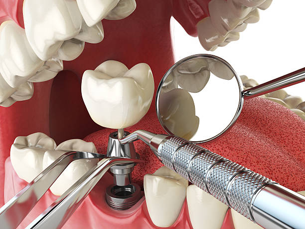 Best Emergency Care for Gum Disease in Manhattan, NY